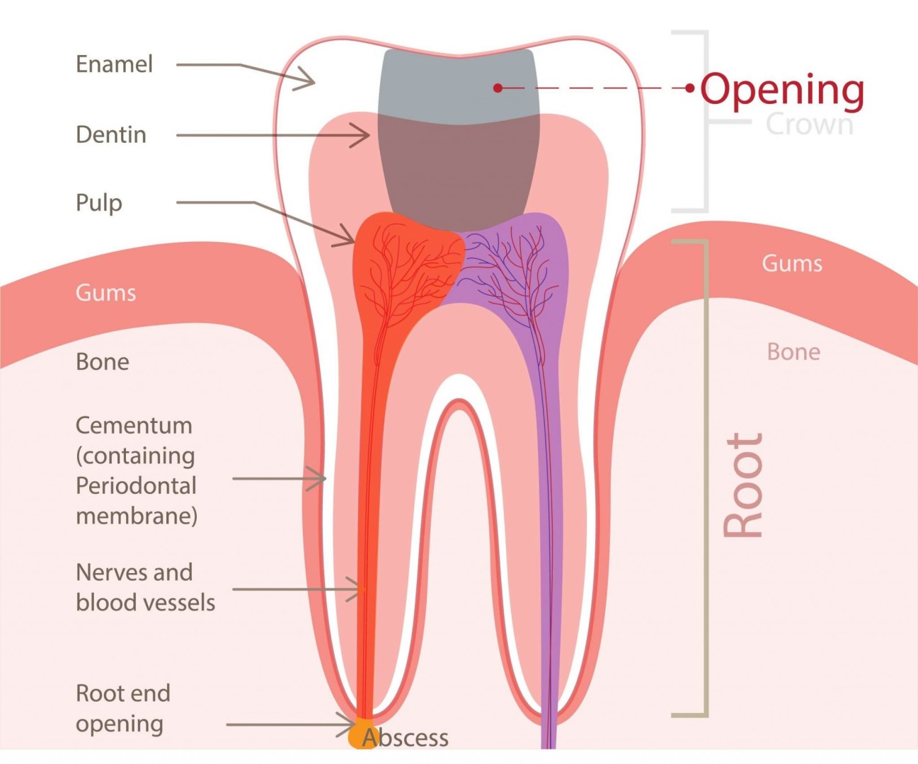 endodontique